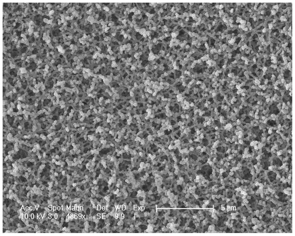 Microporous filter membrane and preparation method thereof