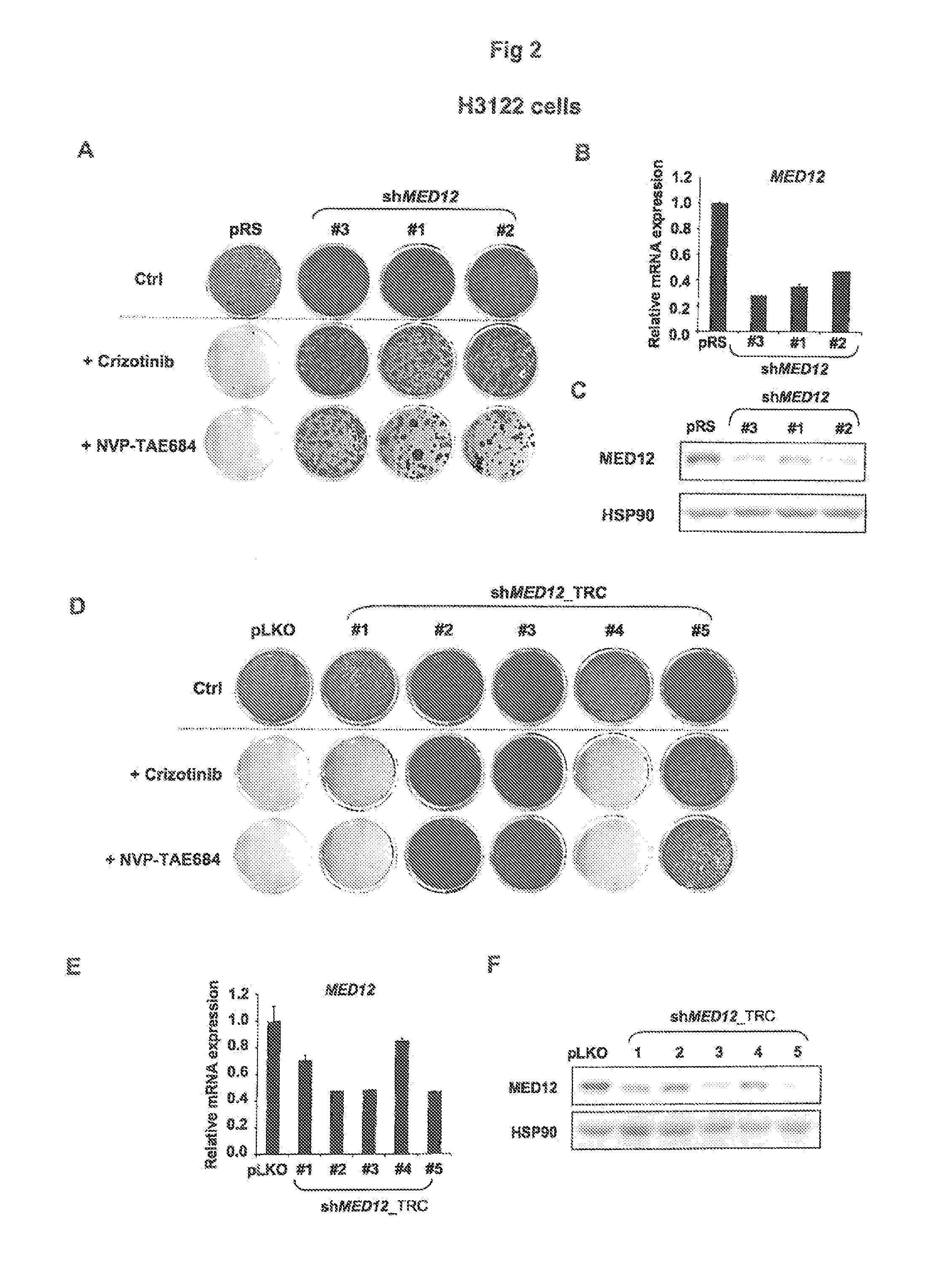 Methods and compositions for predicting resistance to anticancer treatment