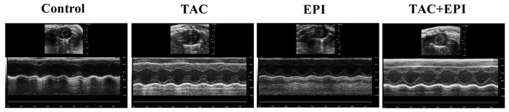 Applications of epicatechin in preparation of drugs for preventing or treating myocardial fibrosis