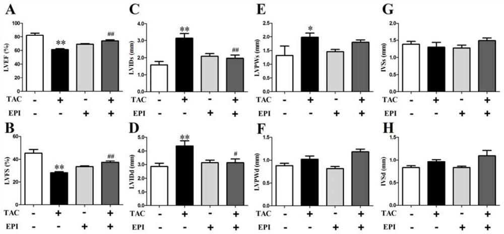 Applications of epicatechin in preparation of drugs for preventing or treating myocardial fibrosis