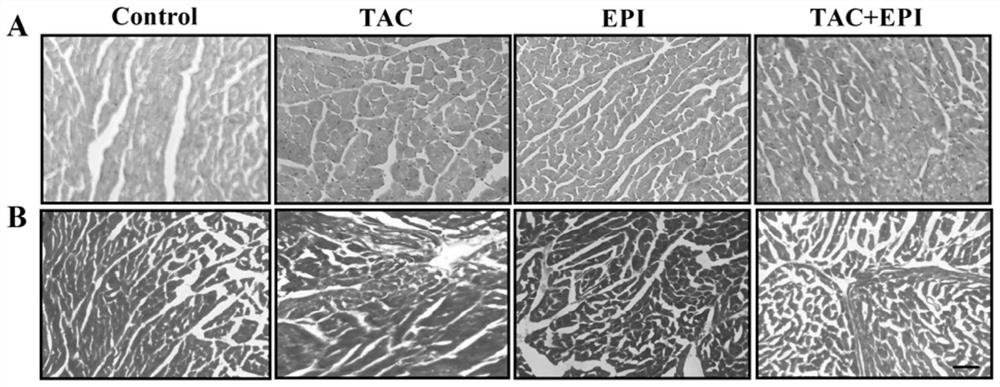 Applications of epicatechin in preparation of drugs for preventing or treating myocardial fibrosis