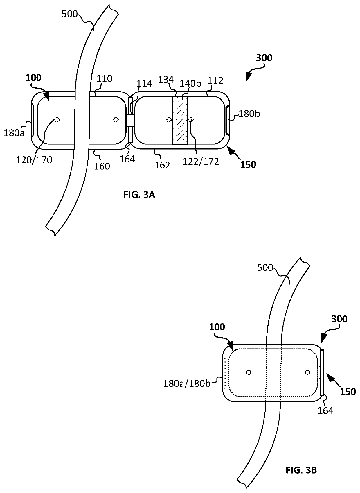 Catheter securing system and methods of use