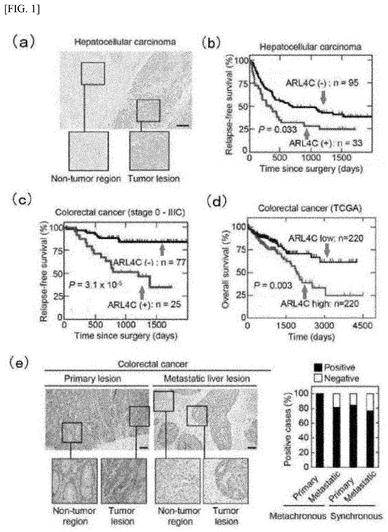 Antisense oligonucleotide targeting arl4c molecule, and nucleic acid drug using antisense oligonucleotide