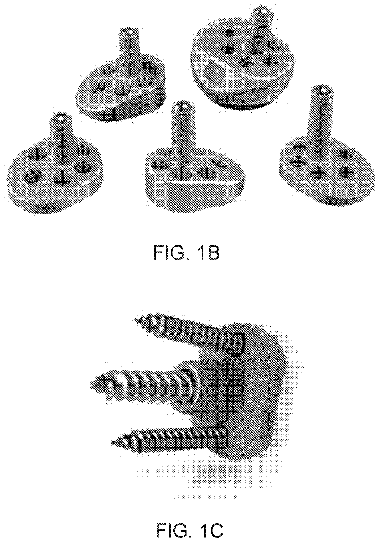 Method for Modeling Glenoid Anatomy and Optimization of Asymmetric Component Design