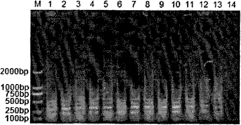 Loop-mediated isothermal amplification detection method of E. wenyoni