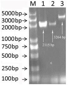 Application of dihydropteroate synthase gene folP