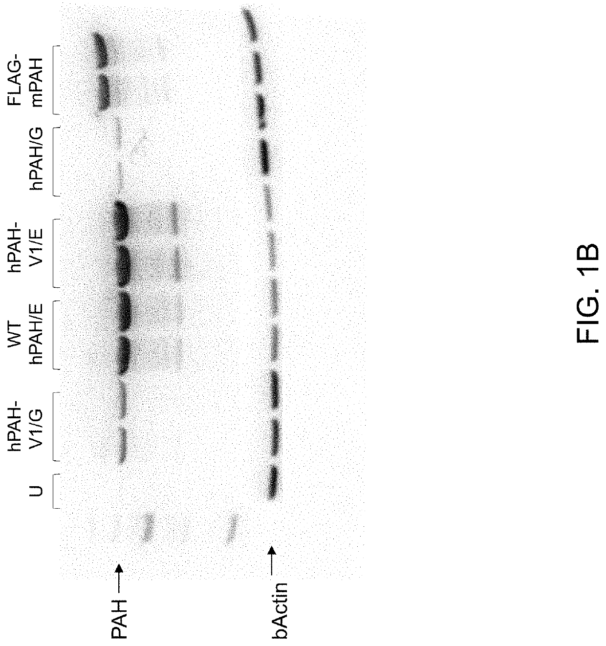 Human pah expression cassette for treatment of pku by liver-directed gene replacement therapy