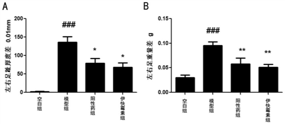 Application of equisetin in preparation of anti-arthritis drugs