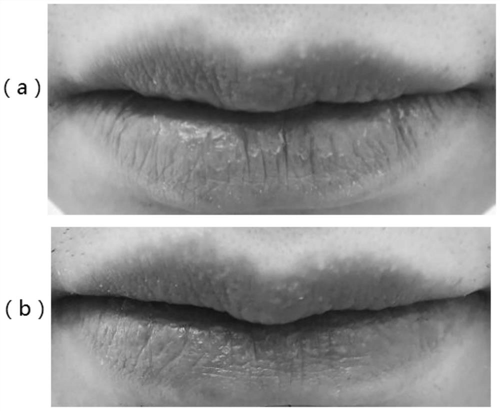Lip protection ointment for softening lip cutin and improving lip state and preparation method