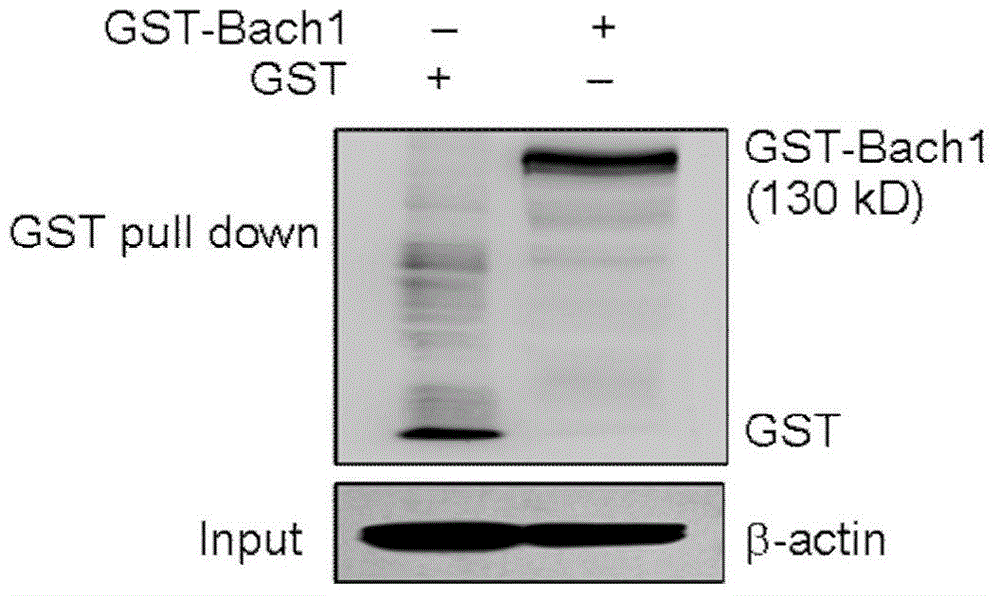 Protein Bach1 for inhibiting angiogenesis and application thereof