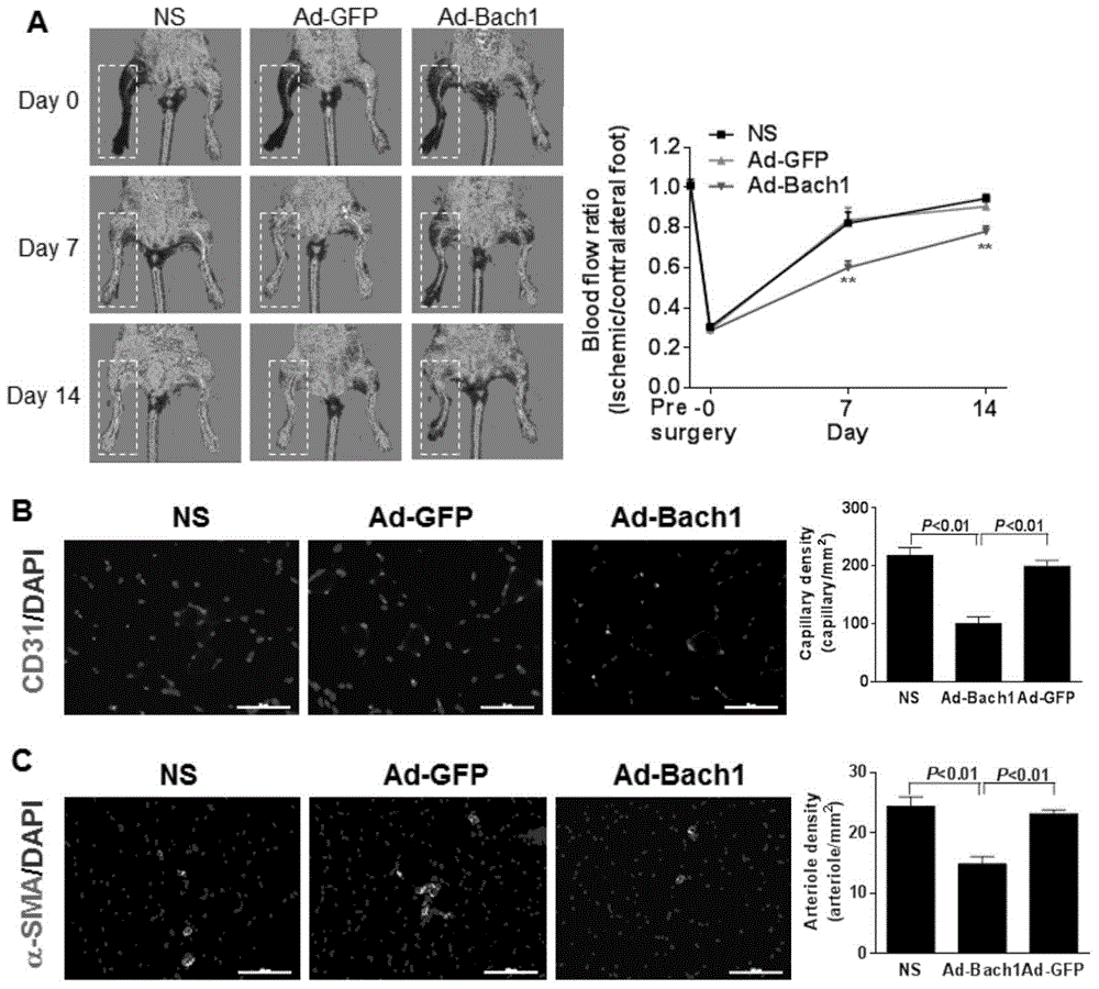 Protein Bach1 for inhibiting angiogenesis and application thereof