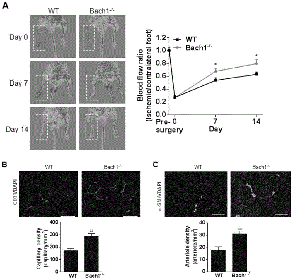 Protein Bach1 for inhibiting angiogenesis and application thereof