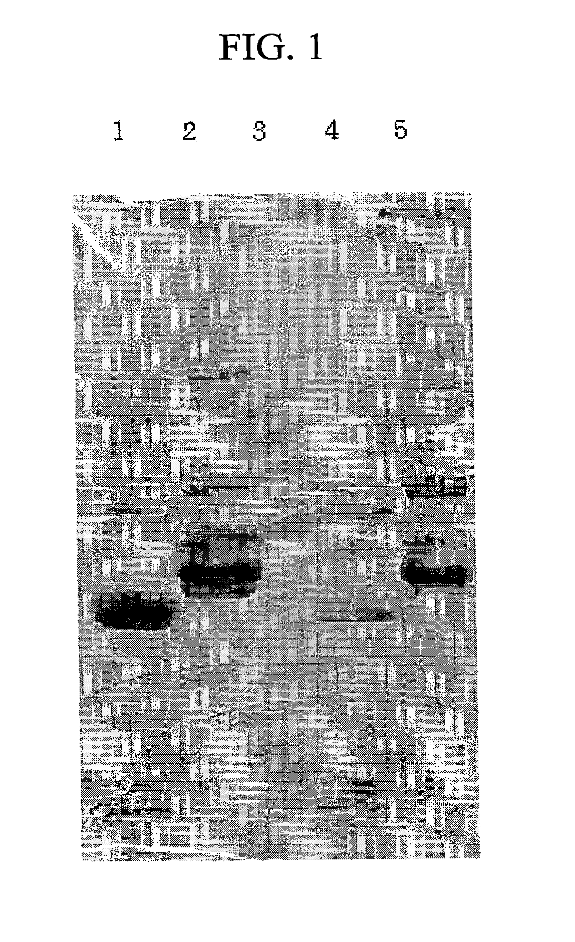 Monoclonal antibody against D-dimer and diagnosis agent for detecting D-dimer, crosslinked fibrin and its derivatives containing D-dimer by using the antibody