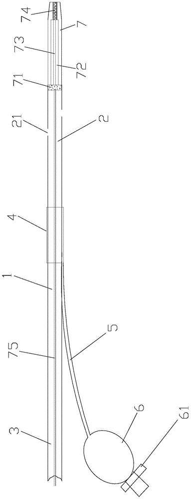 Gastrointestinal tube with magnetic electrodes