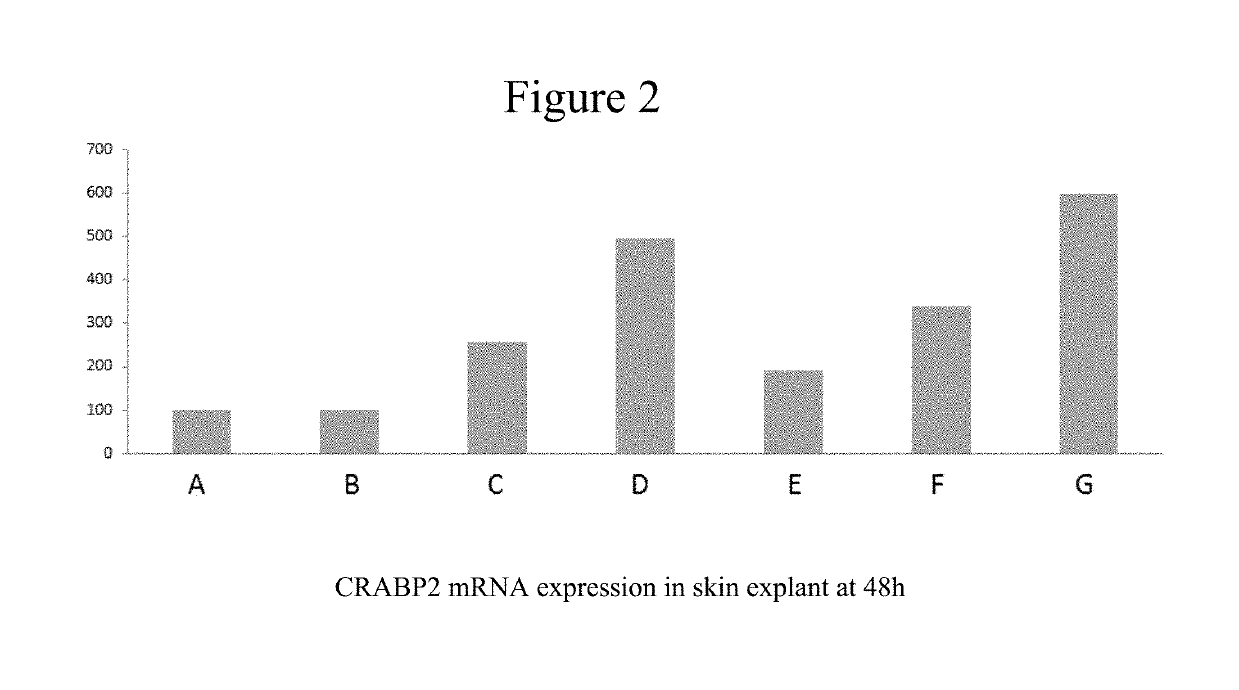 Cosmetic compositions and method of treating the skin