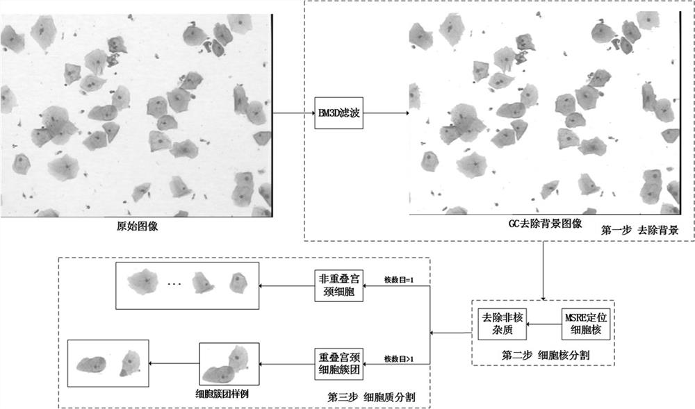 Fine-grained cervical cell image three-stage identification method