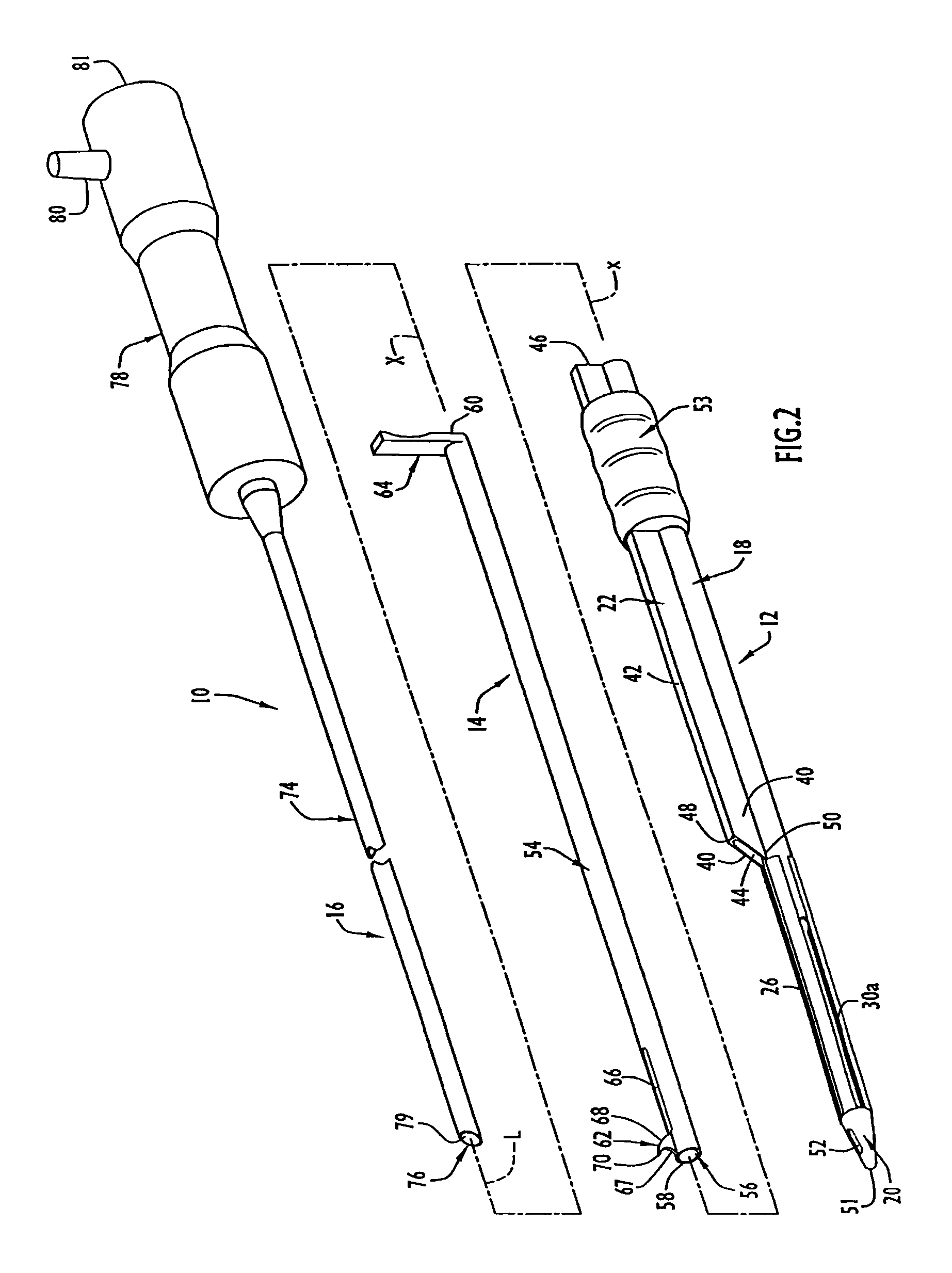 Instruments and methods for minimally invasive carpal tunnel release
