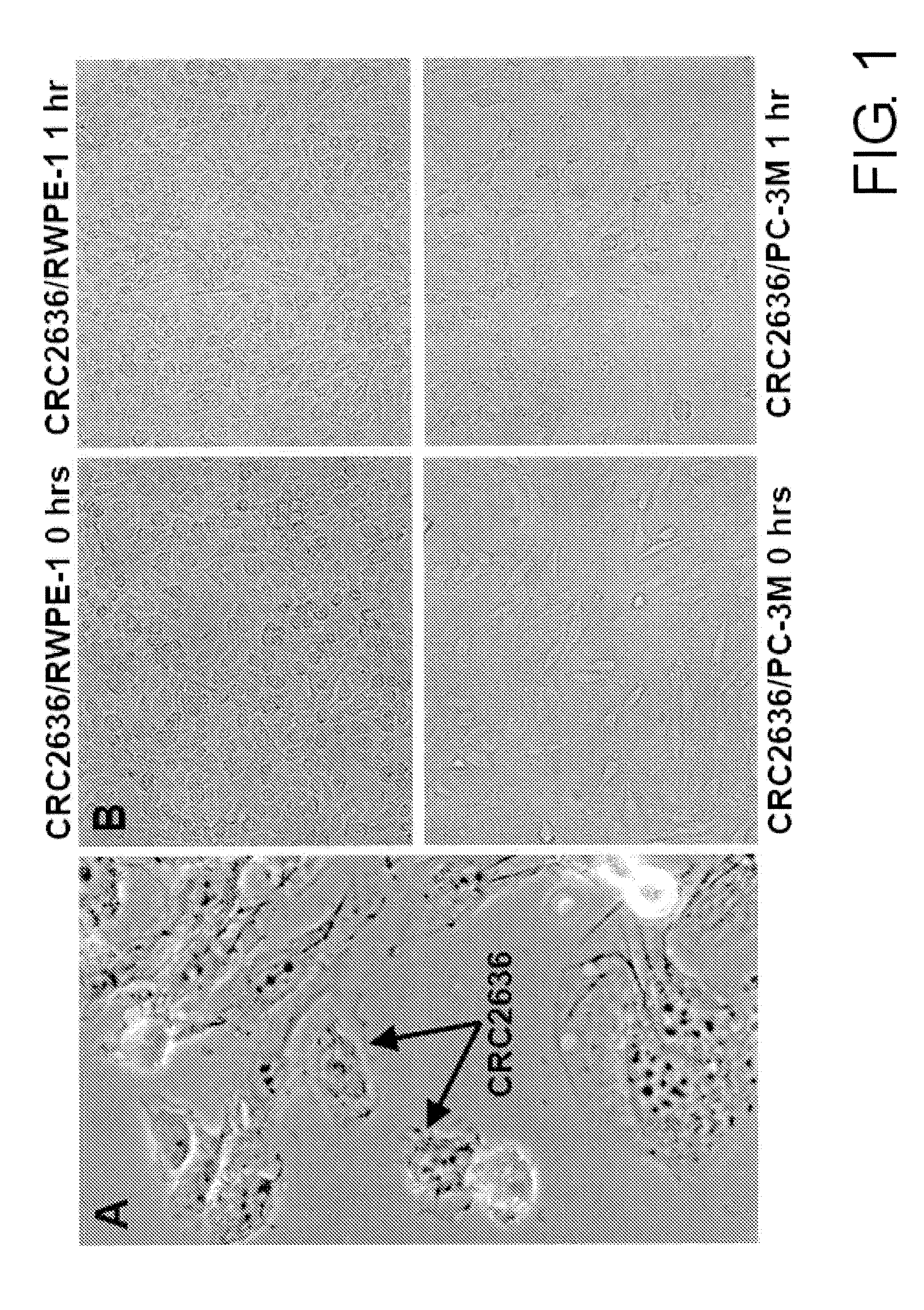 Microorganism Strain CRC2631 of Salmonella typhimurium and its Use as a Cancer Therapeutic