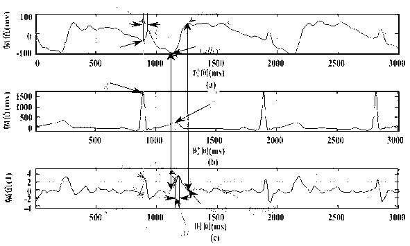 Method for extracting pulse waveform feature points