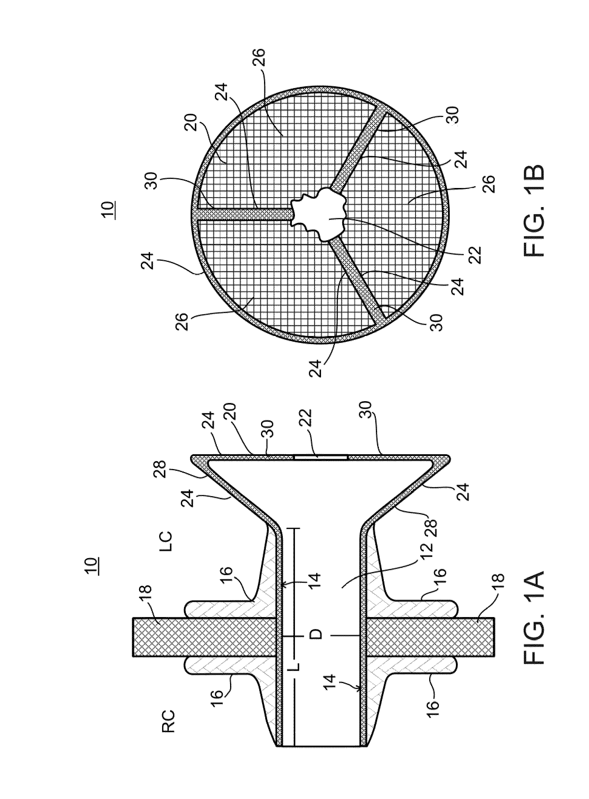 Device and method for regulating pressure in a heart chamber