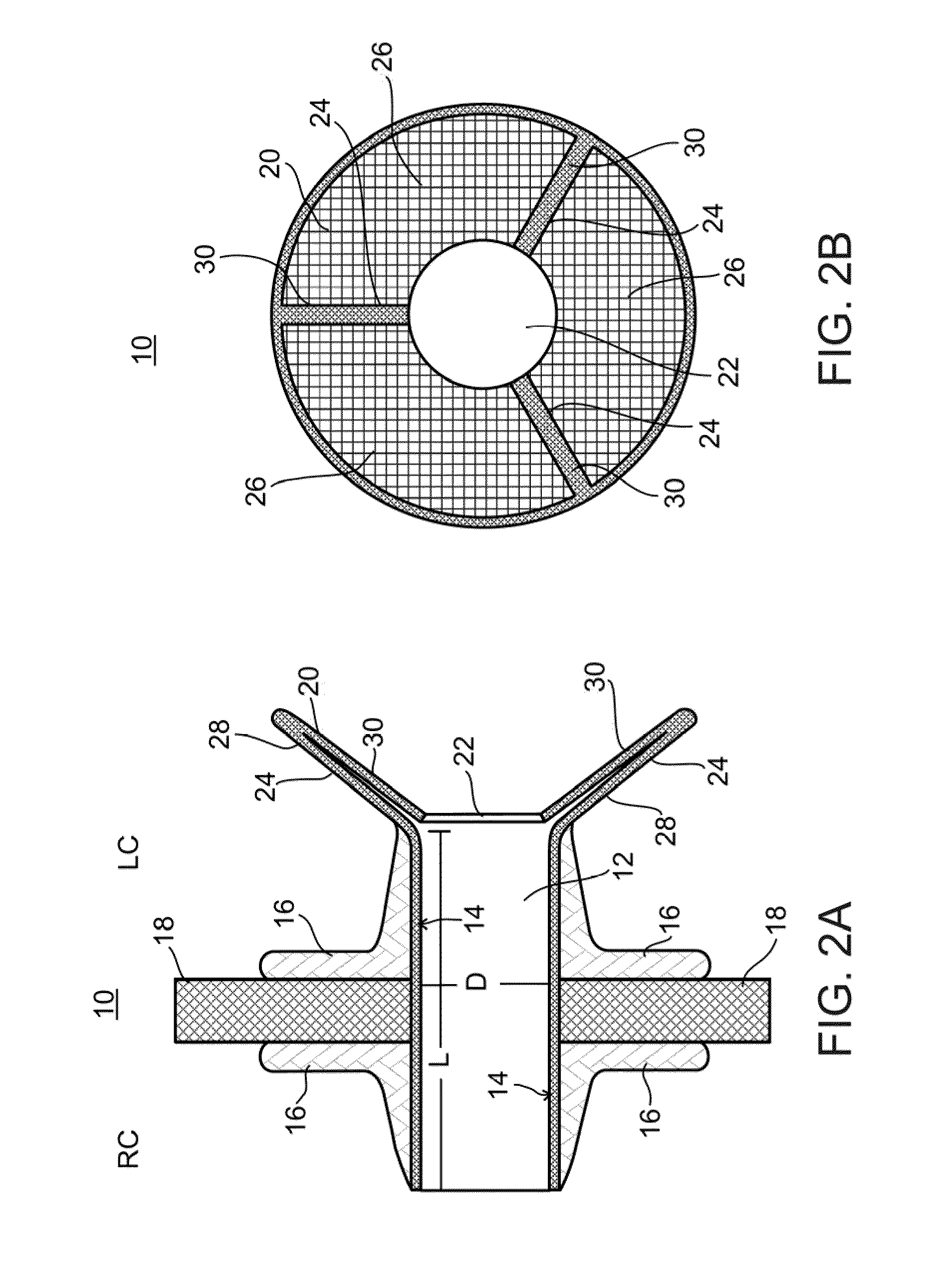 Device and method for regulating pressure in a heart chamber