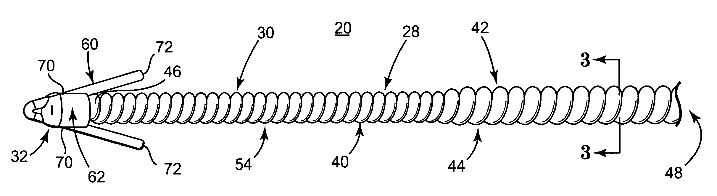 Implantable medical electrical stimulation lead with distal fixation and method