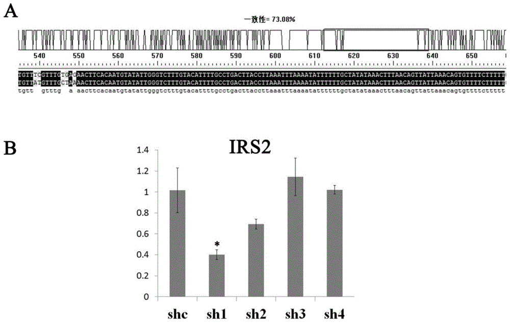 shRNA (short hairpin ribonucleic acid) capable of inhibiting IRS (insulin receptor substrate) 2 gene expression and application thereof