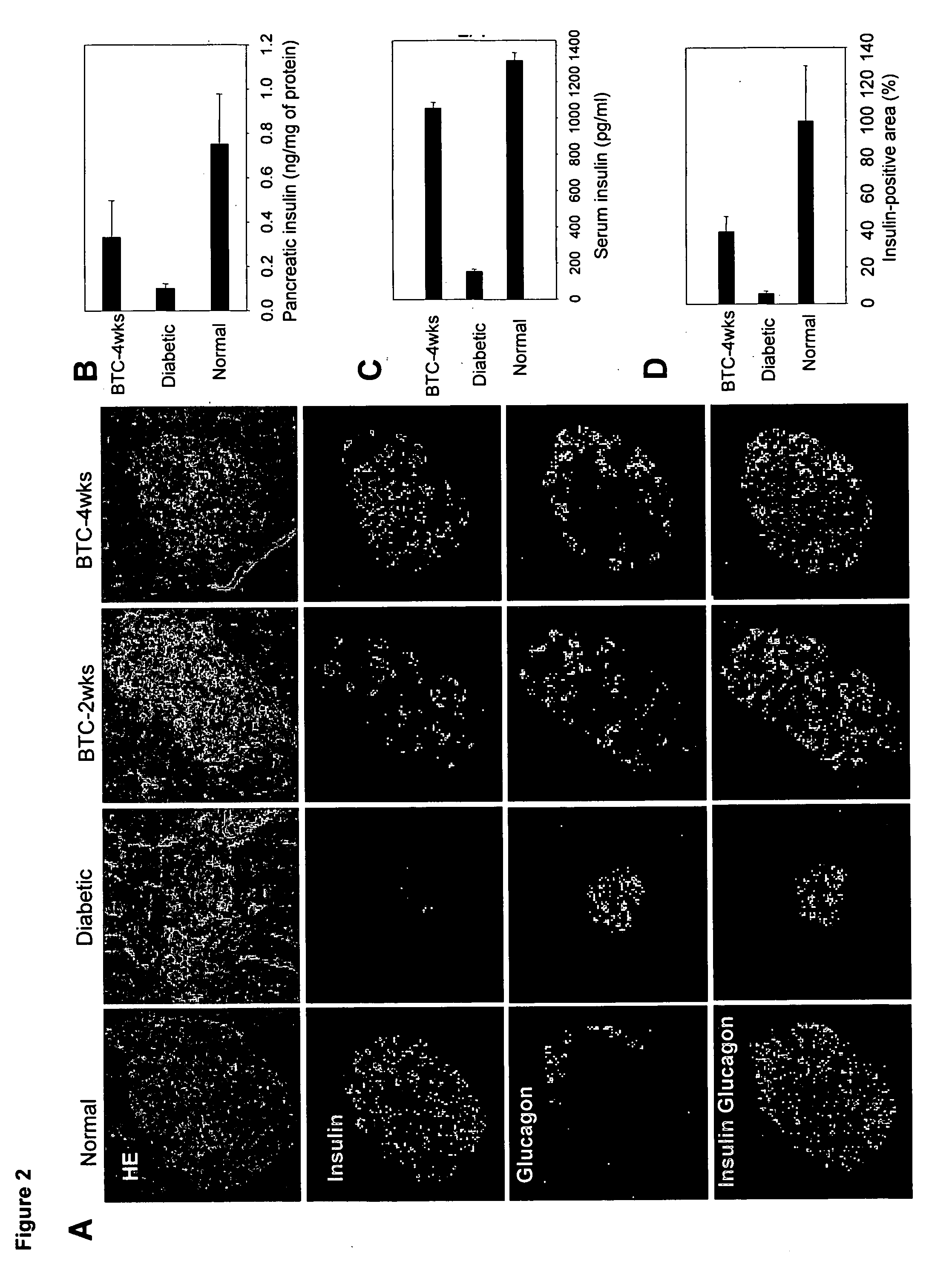 Compositions and methods for the therapeutic treatment of diabetes