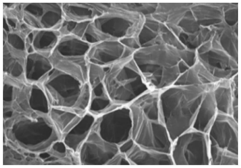 A silk fibroin/functionalized polytrimethylene carbonate hydrogel for repairing endometrium and its preparation method
