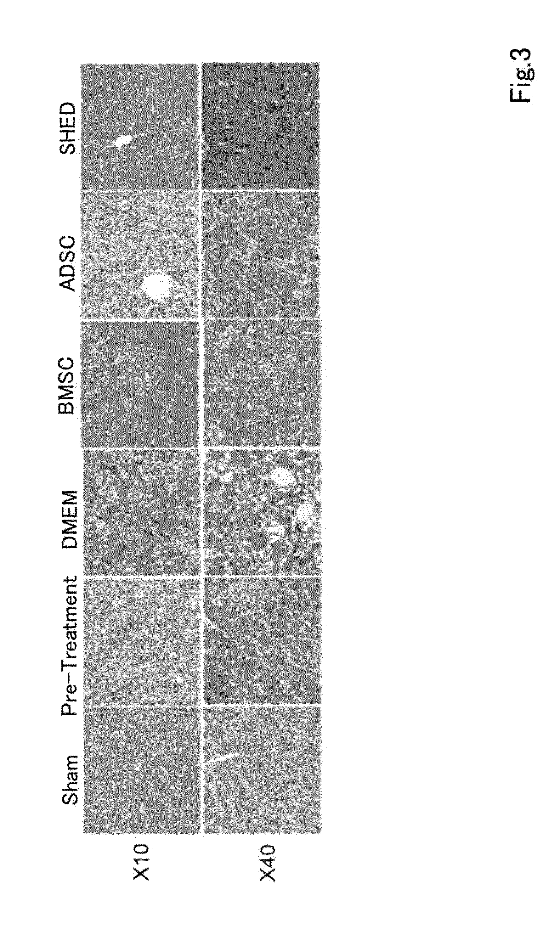 Composition for preventing or treating inflammatory disease