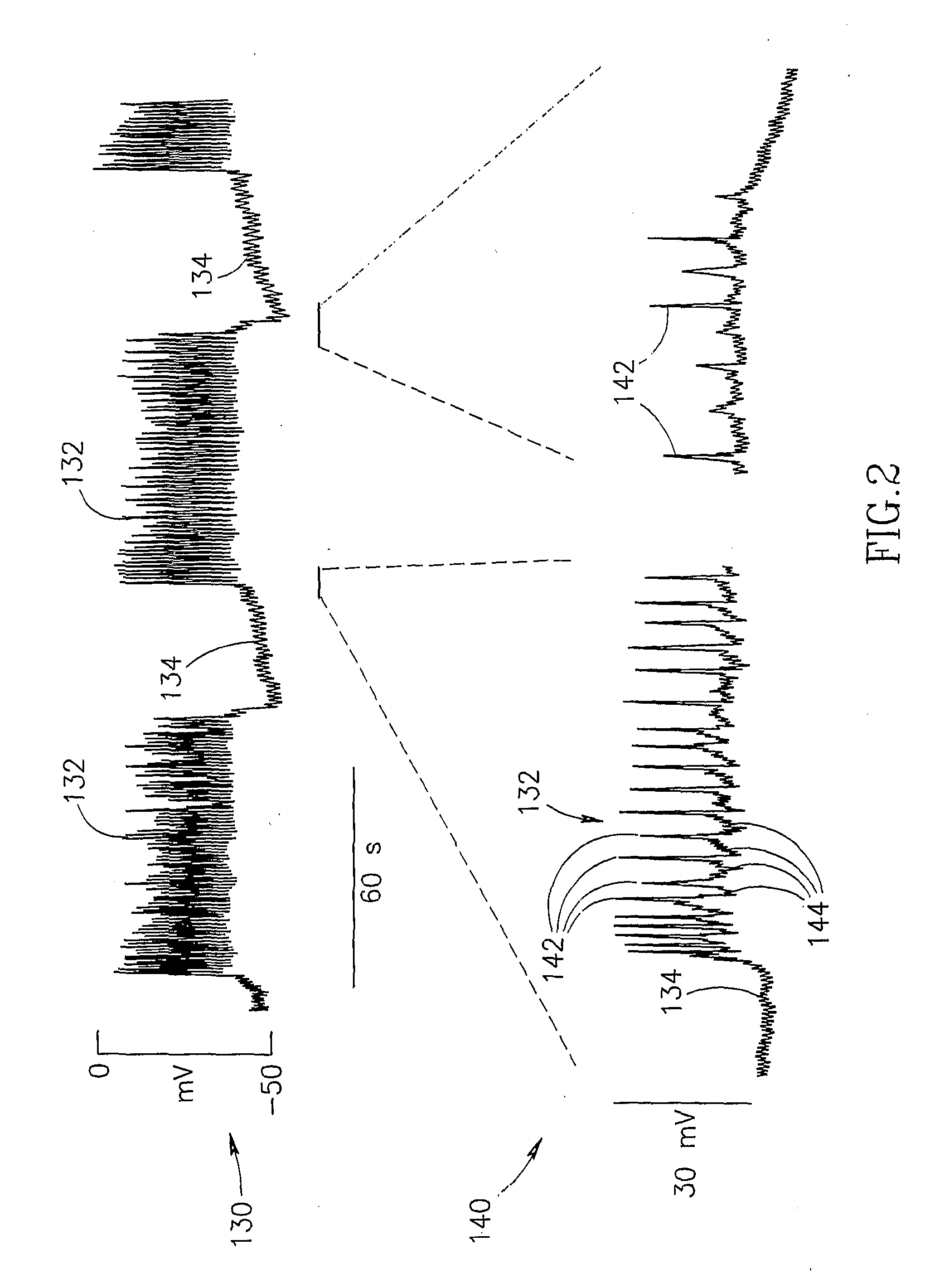 Gastrointestinal Methods And Apparatus For Use In Treating Disorders And Controlling Blood Sugar
