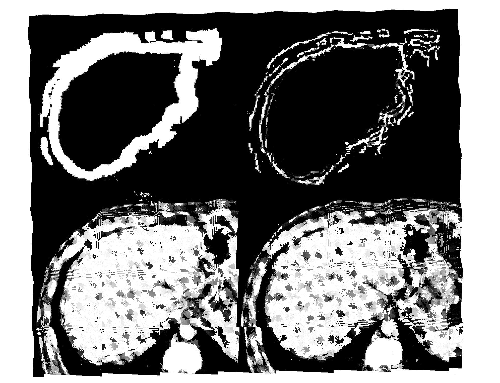 Method for automatically generating liver 3D (three-dimensional) image and accurately positioning liver vascular domination region