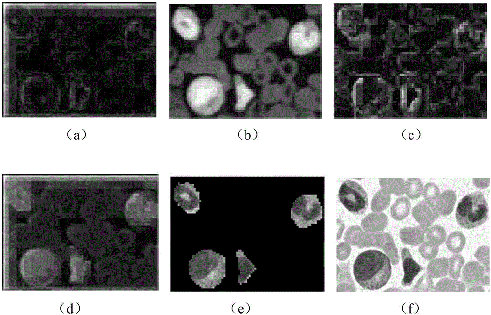 Particle swarm optimization ITTI model-based white cell region extraction method
