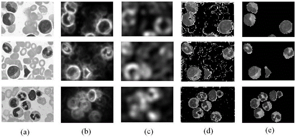 Particle swarm optimization ITTI model-based white cell region extraction method