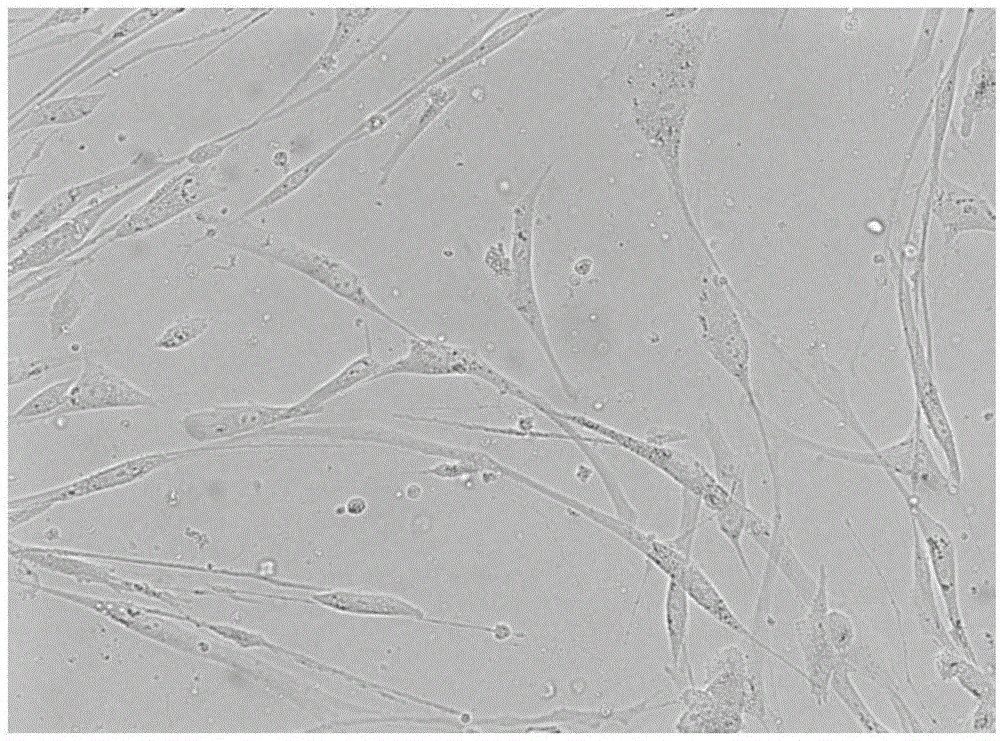 Application of pingyangmycin combined with sodium hyaluronate in drug for treating lymphatic malformation