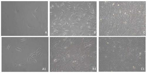 Bone-marrow mesenchymal stem cell culture medium and application thereof