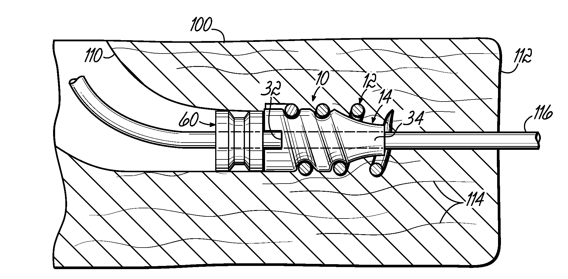 Apparatus and methods for tendon or ligament repair