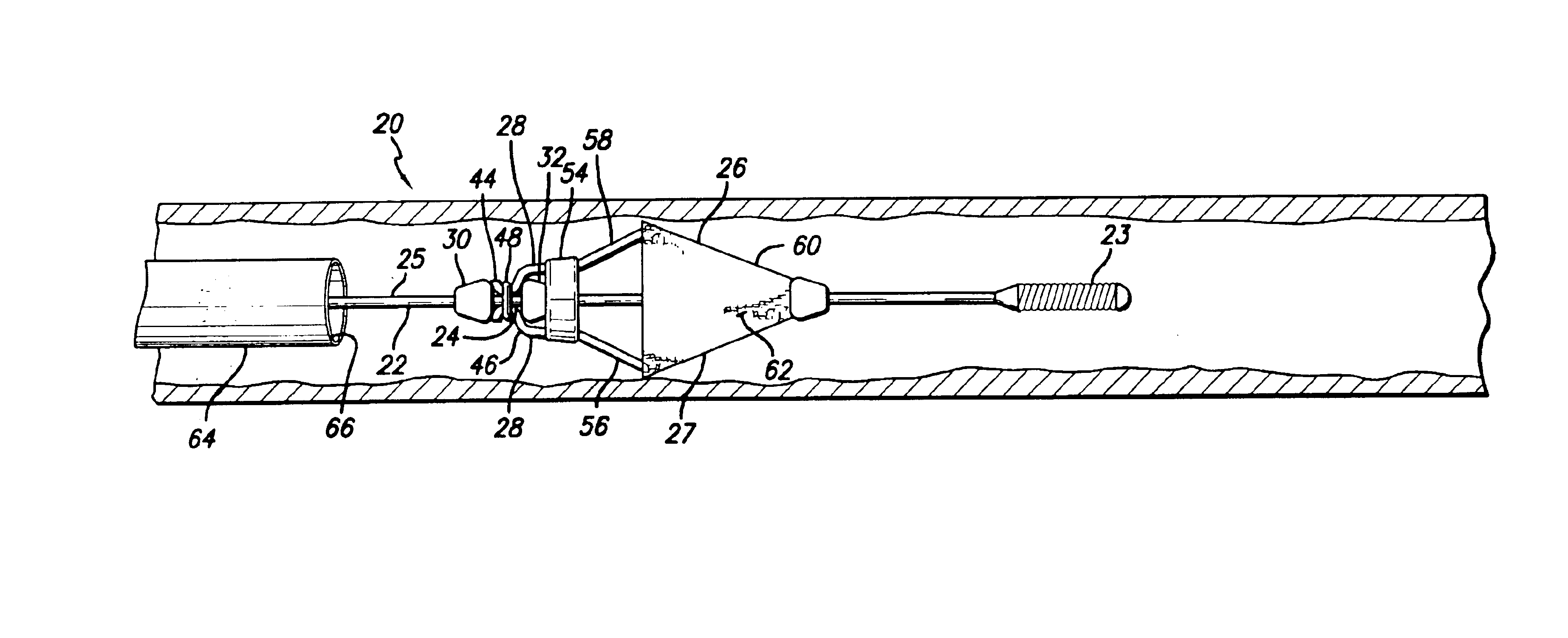 Intraluminal delivery system for an attachable treatment device