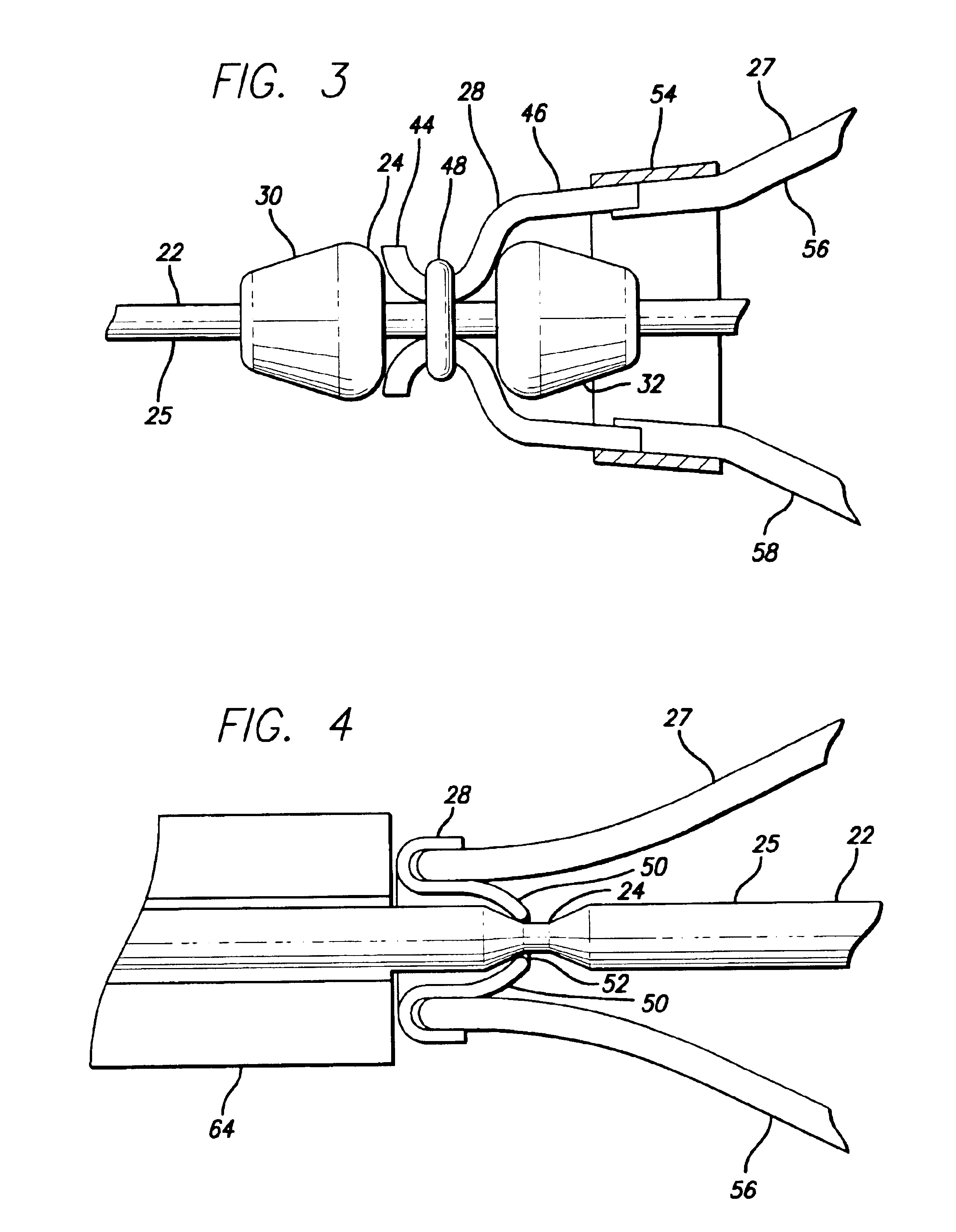 Intraluminal delivery system for an attachable treatment device