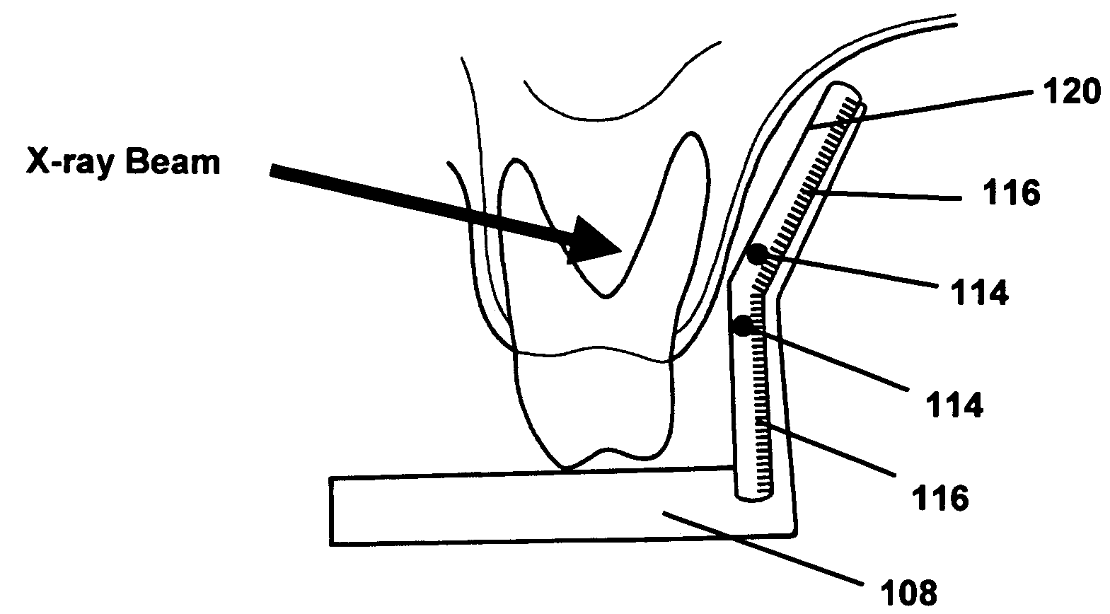 Anatomically conforming intraoral dental radiographic sensor