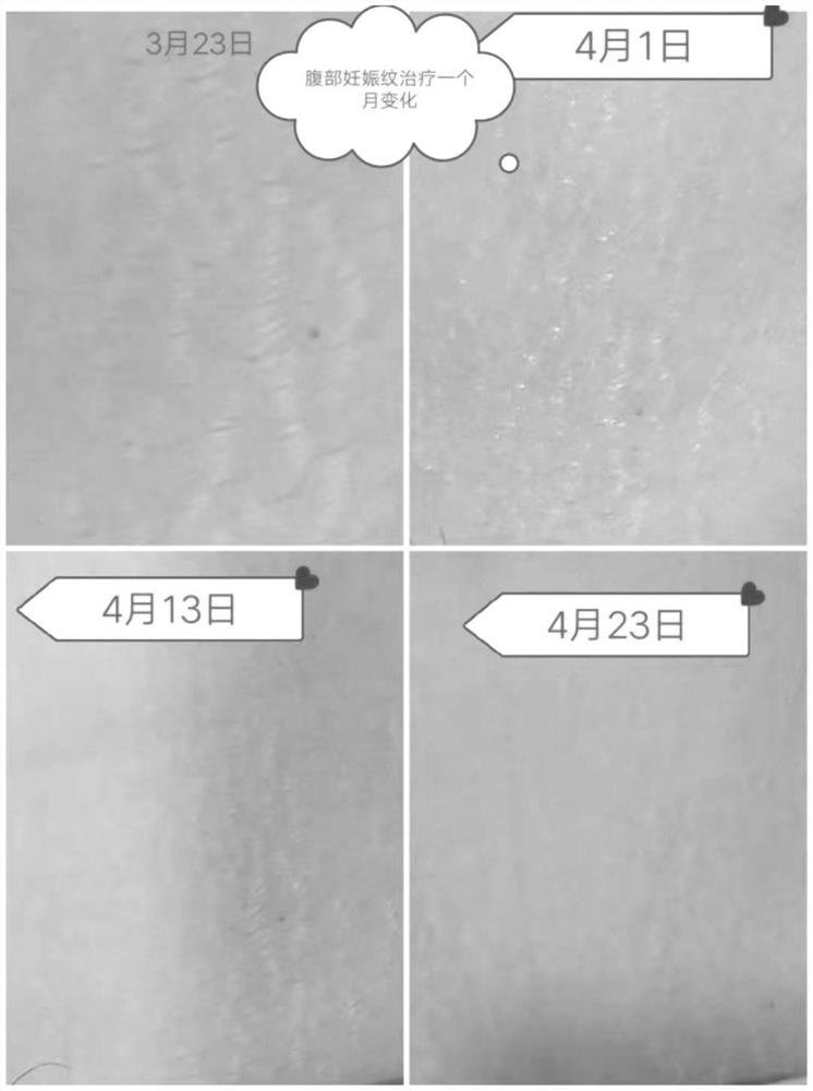 Scar repairing essence as well as preparation method and application thereof