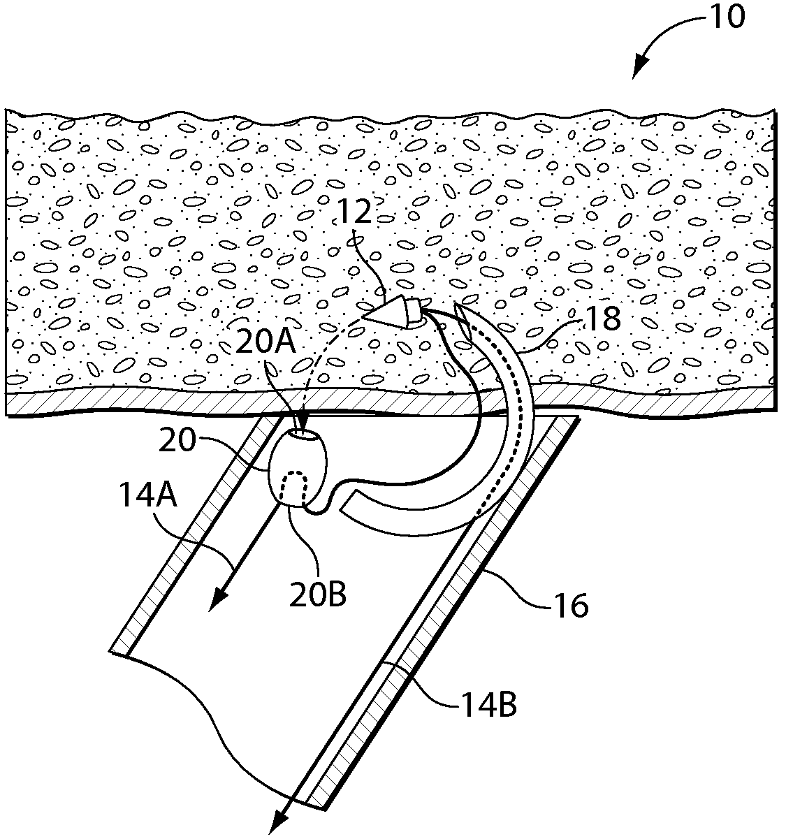 Systems and methods for soft tissue reconstruction
