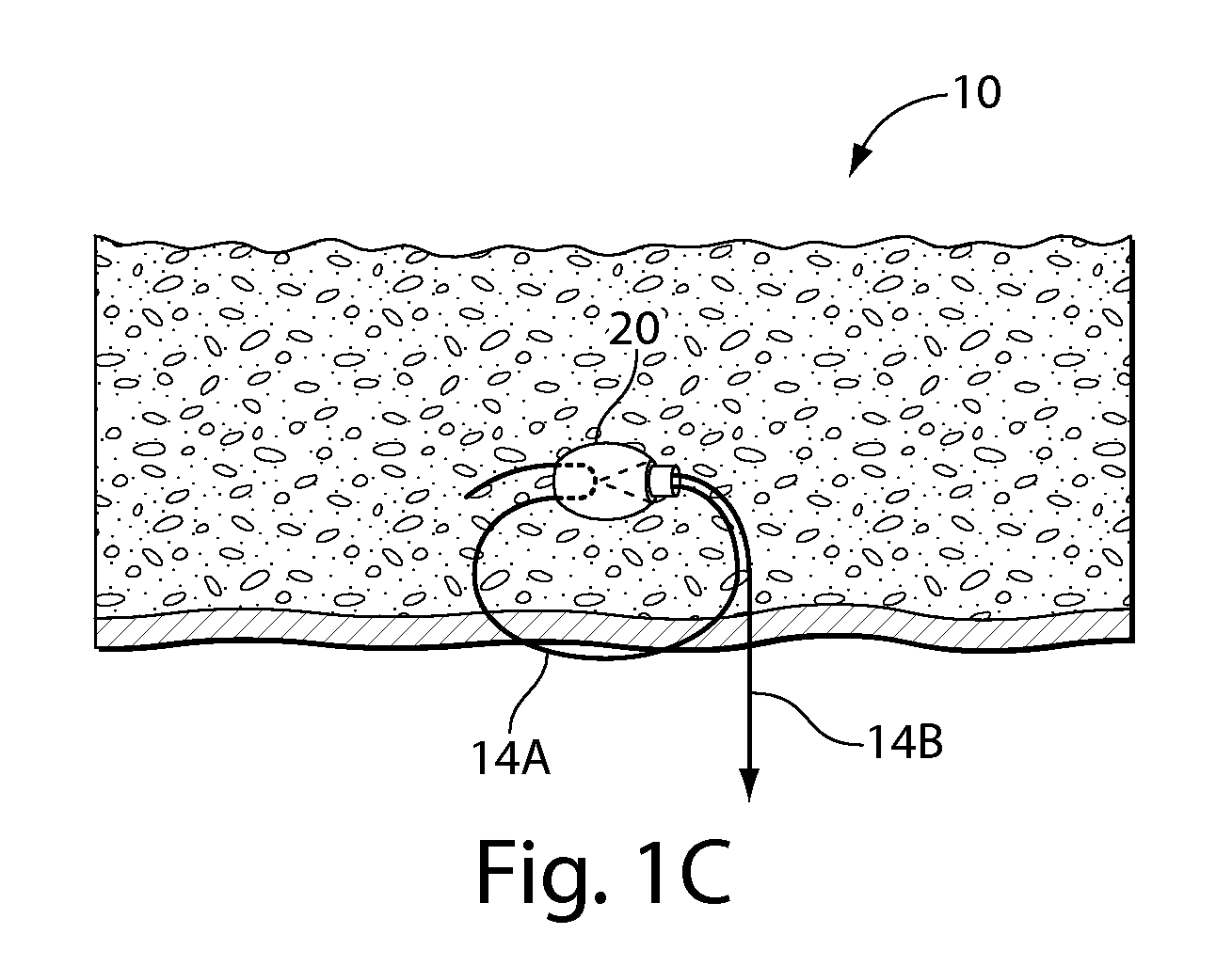 Systems and methods for soft tissue reconstruction
