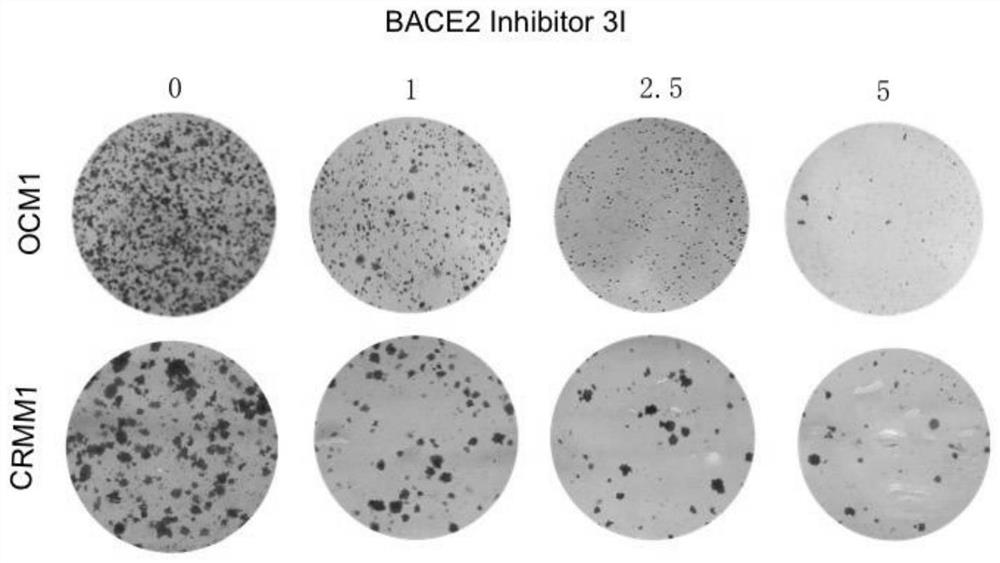 Application of BACE2 inhibitor in preparation of medicine for treating eye melanoma