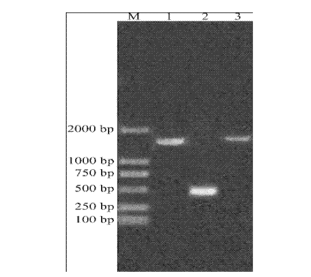 Rhodotorula glutinis acetyl coenzyme A carboxylase gene and clone and function verification method and application thereof