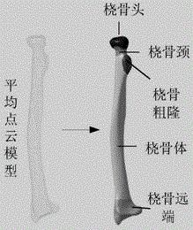 Characteristic parameter based bone fracture plate serial design method