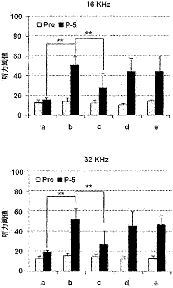 Pharmaceutical composition for preventing or treating hearing impairment containing cilostazol and ginkgo biloba extract as active ingredients
