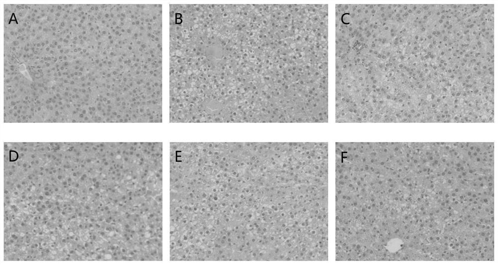 A traditional Chinese medicine composition containing achyranthes bidentata for treating non-alcoholic fatty liver of yin deficiency and excessive heat, and its preparation method and application