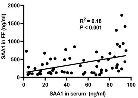 Application of serum amyloid A1 in preparation of biomarker for diagnosing polycystic ovarian syndrome