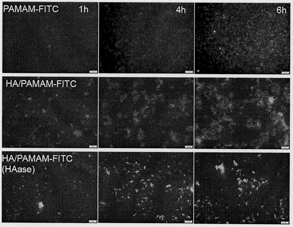 Multilevel targeted hyaluronic acid nanoparticle loaded with methotrexate and preparing method thereof